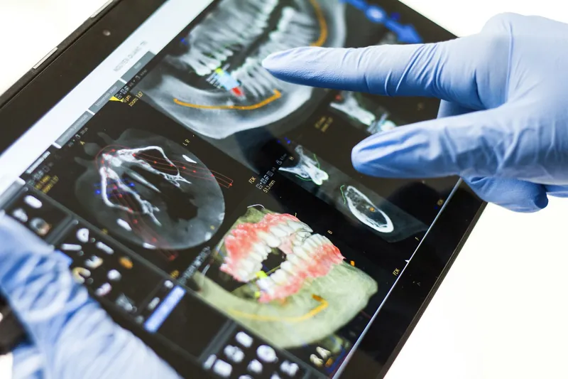Exame de imagem odontológico analisado em um tablet